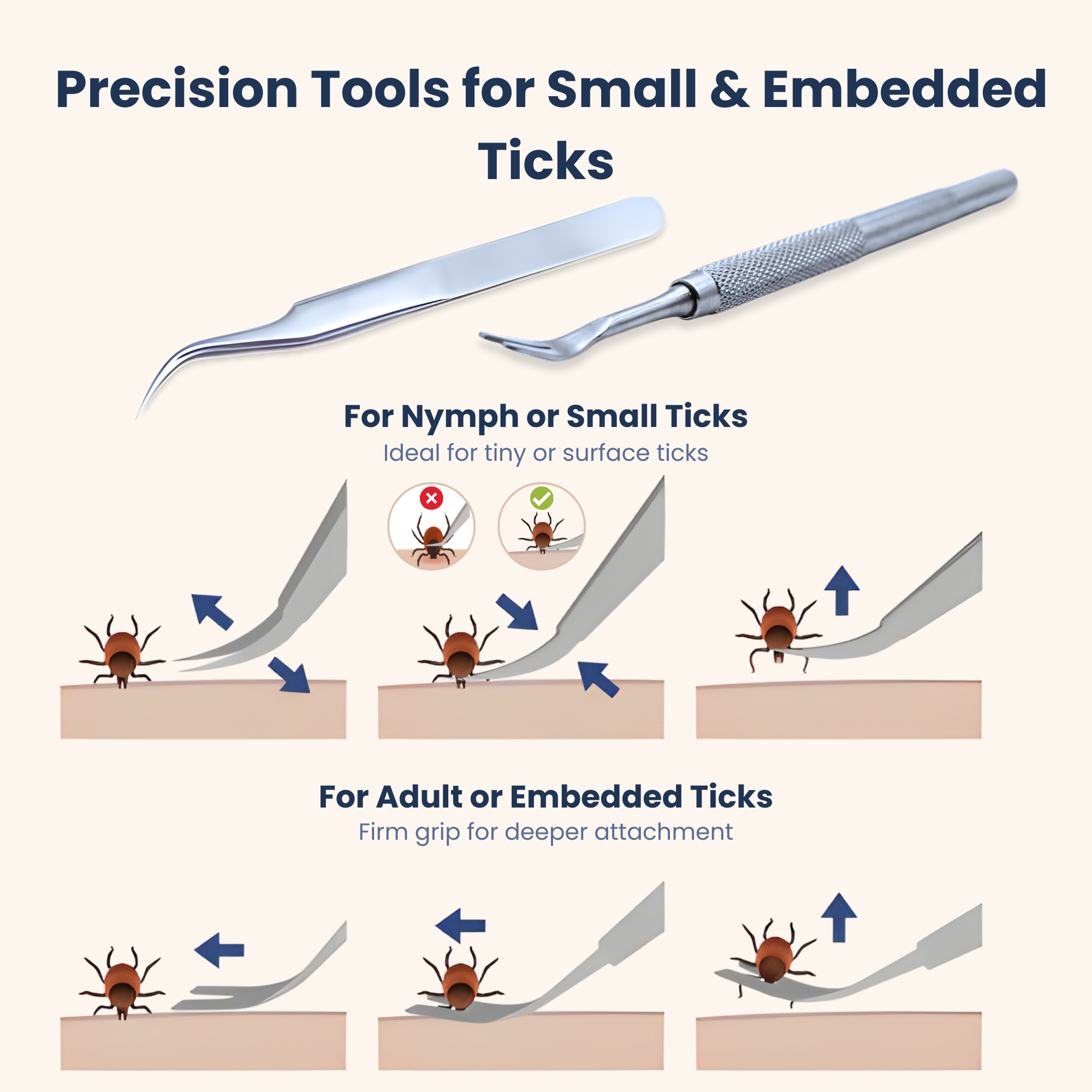 PetLuxe Care Tick Removal Kit for Dogs & Cats